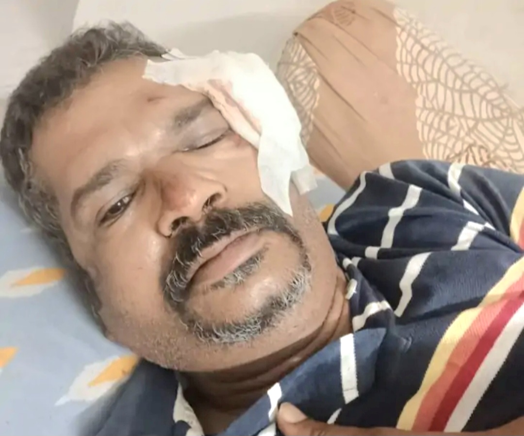 तेज रफ्तार से आया कार सवार टक्कर मार हुआ फरार, पुलिस जुटी तलाश में