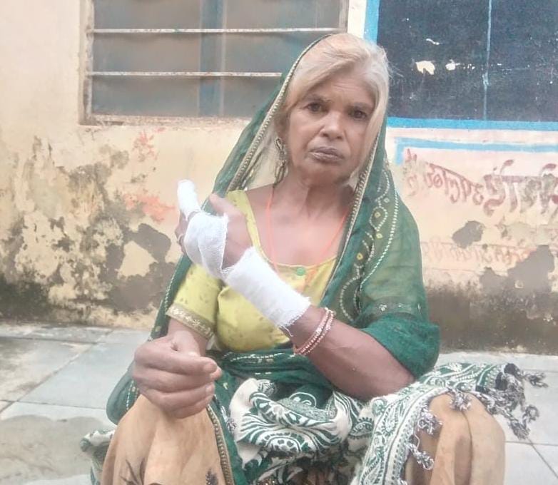 चित्तौड़गढ़ / बस्सी - शिवपुरा गाँव में चोरों का आतंक, तीन महिलाएं घायल