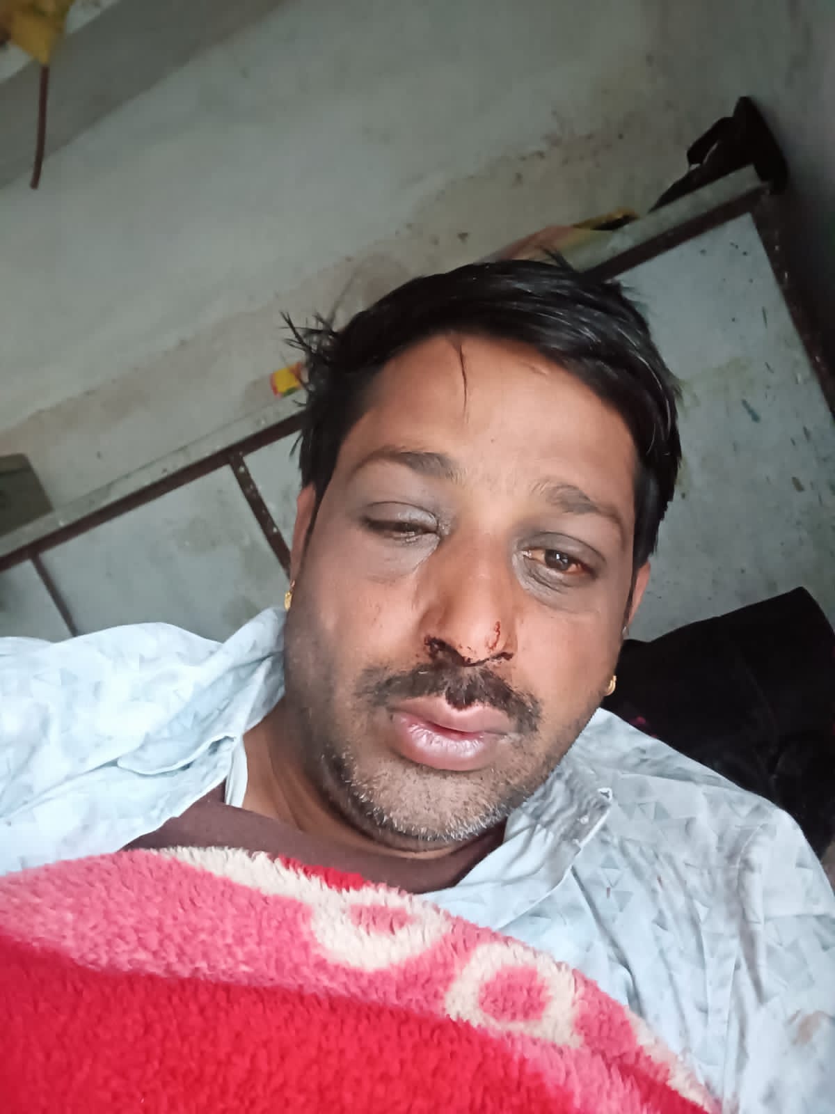 चित्तौड़गढ़ / बेंगू - रंजिश में युवक के साथ हुई मारपीट, मामला दर्ज कर पुलिस जुटी जांच में